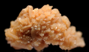 Calcium Phosphate Kidney Stones